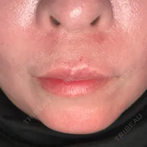 共立美容外科 神戸三宮院口コミ