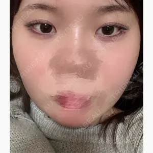 ルラ美容クリニック 名古屋栄院 / ルラスキンクリニック 名古屋栄院口コミ