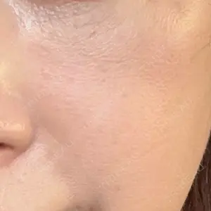 美容皮膚科エルムクリニック 大阪院口コミ