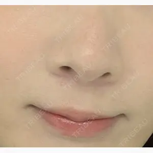 EMMO FACE CLINIC 東京三田院口コミ