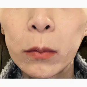 TCB東京中央美容外科 神戸院口コミ