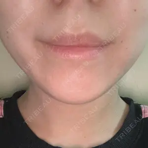 池袋美容クリニック口コミ