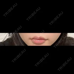 ルラ美容クリニック 名古屋栄院 / ルラスキンクリニック 名古屋栄院口コミ