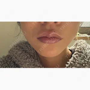 PRO CLINIC プロクリニック 銀座院口コミ