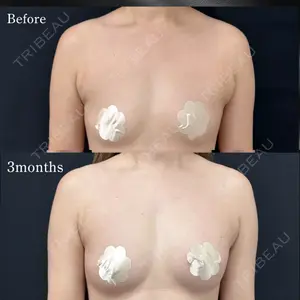 湘南美容クリニック Regno 銀座院口コミ