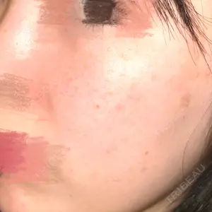 ルラ美容クリニック 横浜院口コミ