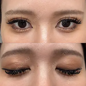 アリエル美容クリニック 大宮院口コミ