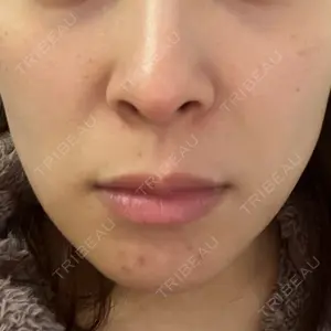 TCB東京中央美容外科 宇都宮院口コミ