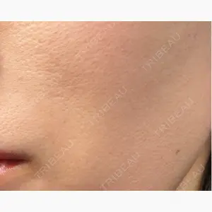 名駅なぎクリニック口コミ