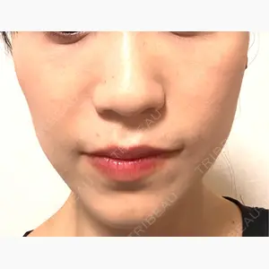 TCB東京中央美容外科 名古屋栄院口コミ