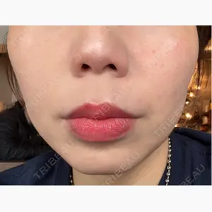 Tokyo Tensei Clinic 大阪梅田院口コミ