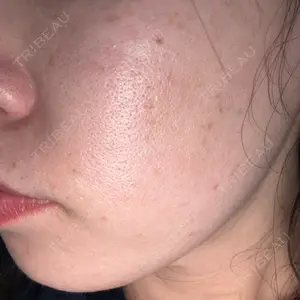 エイトビューティークリニック 新宿院口コミ