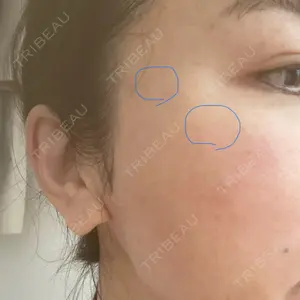 ルラ美容クリニック 札幌大通り院口コミ