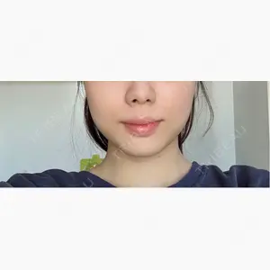 BAO CLINIC 梅田院口コミ