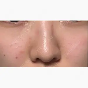 ルラ美容クリニック 仙台院 / ルラスキンクリニック 仙台院口コミ