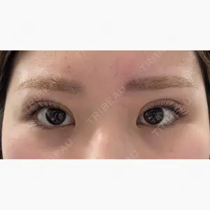 YBC横浜美容外科 池袋院口コミ