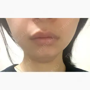 L‘amour clinic Tokyo【ラムールクリニック東京】口コミ