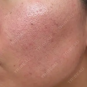 DAILY SKIN CLINIC 新宿院口コミ