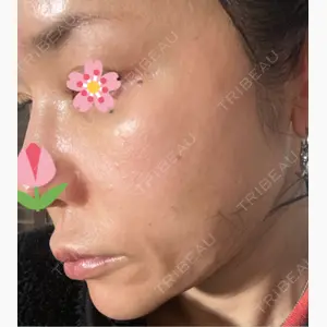 ゆきスキンクリニック 東池袋口コミ