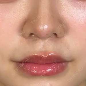 アリエル美容クリニック 大宮院口コミ