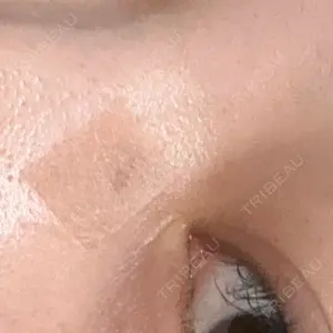 ルラ美容クリニック 上野院口コミ