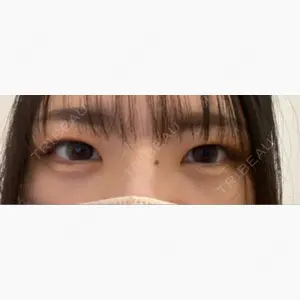 R Beauty CLINIC 銀座院口コミ