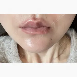 札幌美容外科ネビュラクリニック口コミ