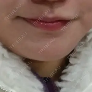 YBC横浜美容外科 立川院口コミ