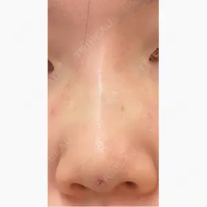 Tokyo Tensei Clinic 新宿院口コミ