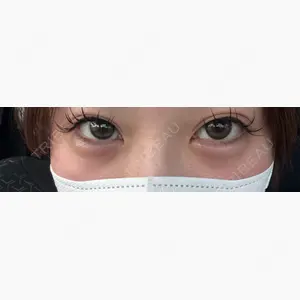 アリエル美容クリニック 水戸院口コミ
