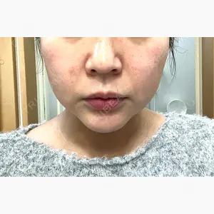 ウィルビークリニック 立川院口コミ