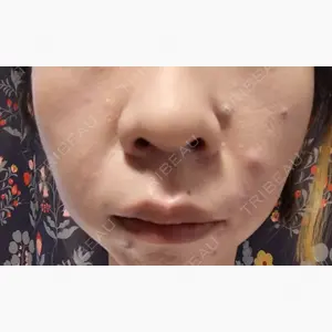 KM新宿クリニック口コミ