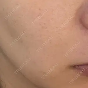 広島本通り美容クリニック口コミ