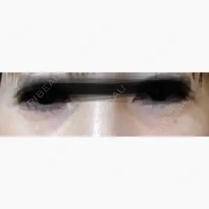 ルラ美容クリニック 広島院口コミ