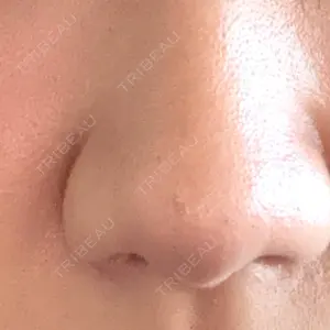 ルラ美容クリニック 新宿院口コミ