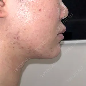 共立美容外科 神戸三宮院口コミ