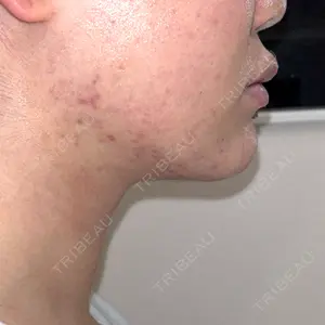 ルラ美容クリニック 神戸院口コミ