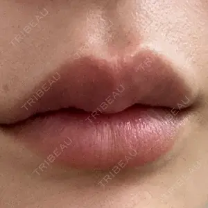 フィラークリニック 名古屋栄院口コミ