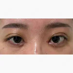 HAAB×DREAM BEAUTY CLINIC 東京本院口コミ