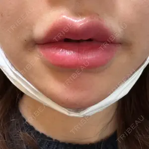 DMTC美容皮膚科 大宮院口コミ