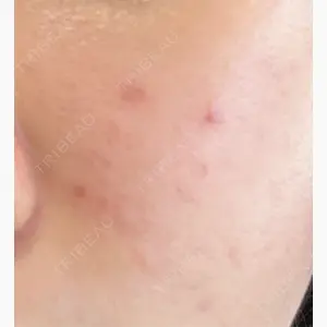 Fellez Clinic【フェルズクリニック】口コミ