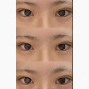 ASTRA BEAUTY CLINIC口コミ