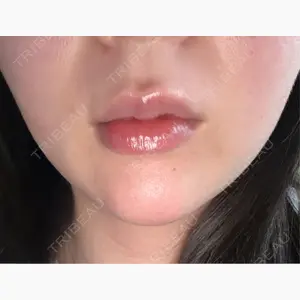 ルラ美容クリニック 新潟院口コミ