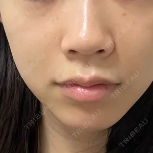 EMMO FACE CLINIC 東京三田院口コミ