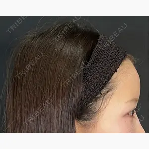 藤・ナチュレ美容クリニック 銀座院口コミ