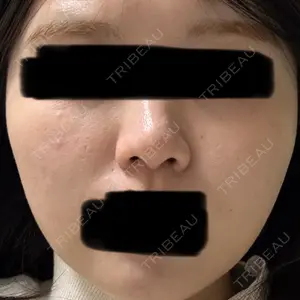 レナータクリニック 立川院口コミ