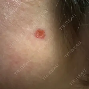 ルラ美容クリニック 大宮院 / ルラスキンクリニック 大宮院口コミ