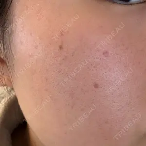 ライズワン美容皮膚科クリニック口コミ