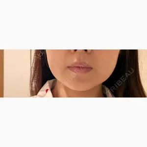 LA CLEF CLINIC（ラクレクリニック）口コミ