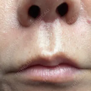 YBC横浜美容外科 池袋院口コミ